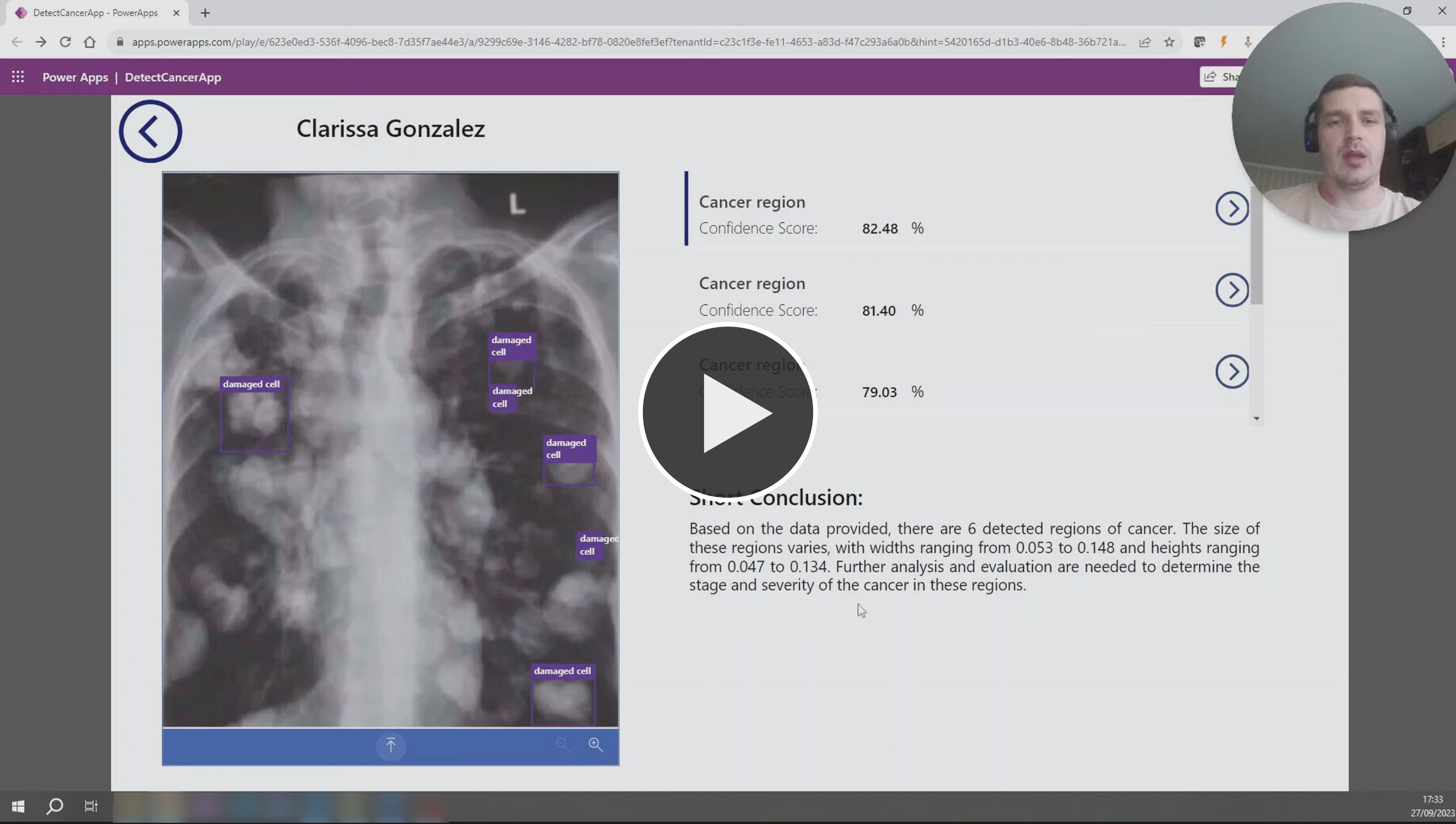 The Detect Cancer app identifies potential tumors and anomalies to help doctors with diagnosis.