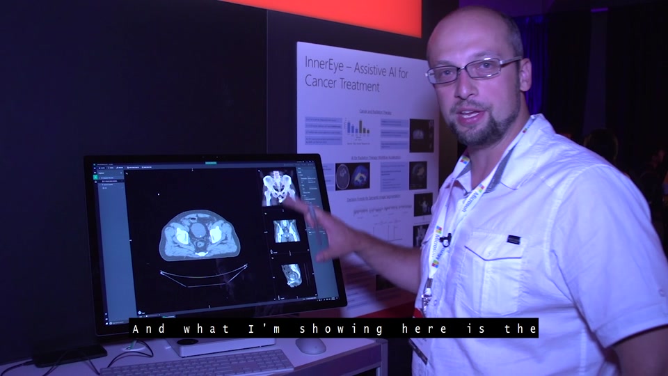 Tech Showcase: Project InnerEye – Assistive AI for Cancer Treatment