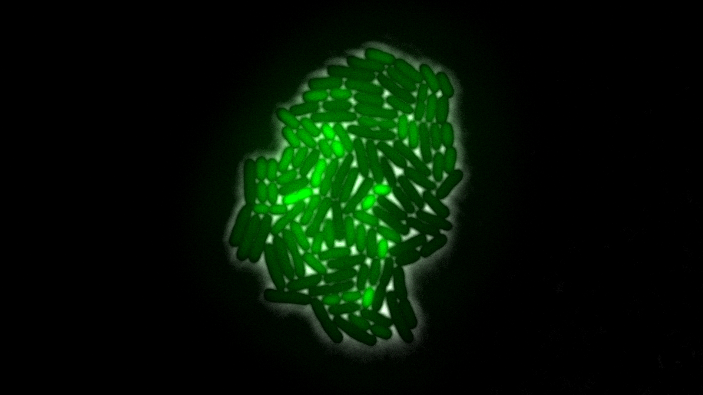 bacteria under a microscope