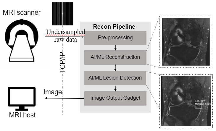 machine learning image reconstruction workflow illustration