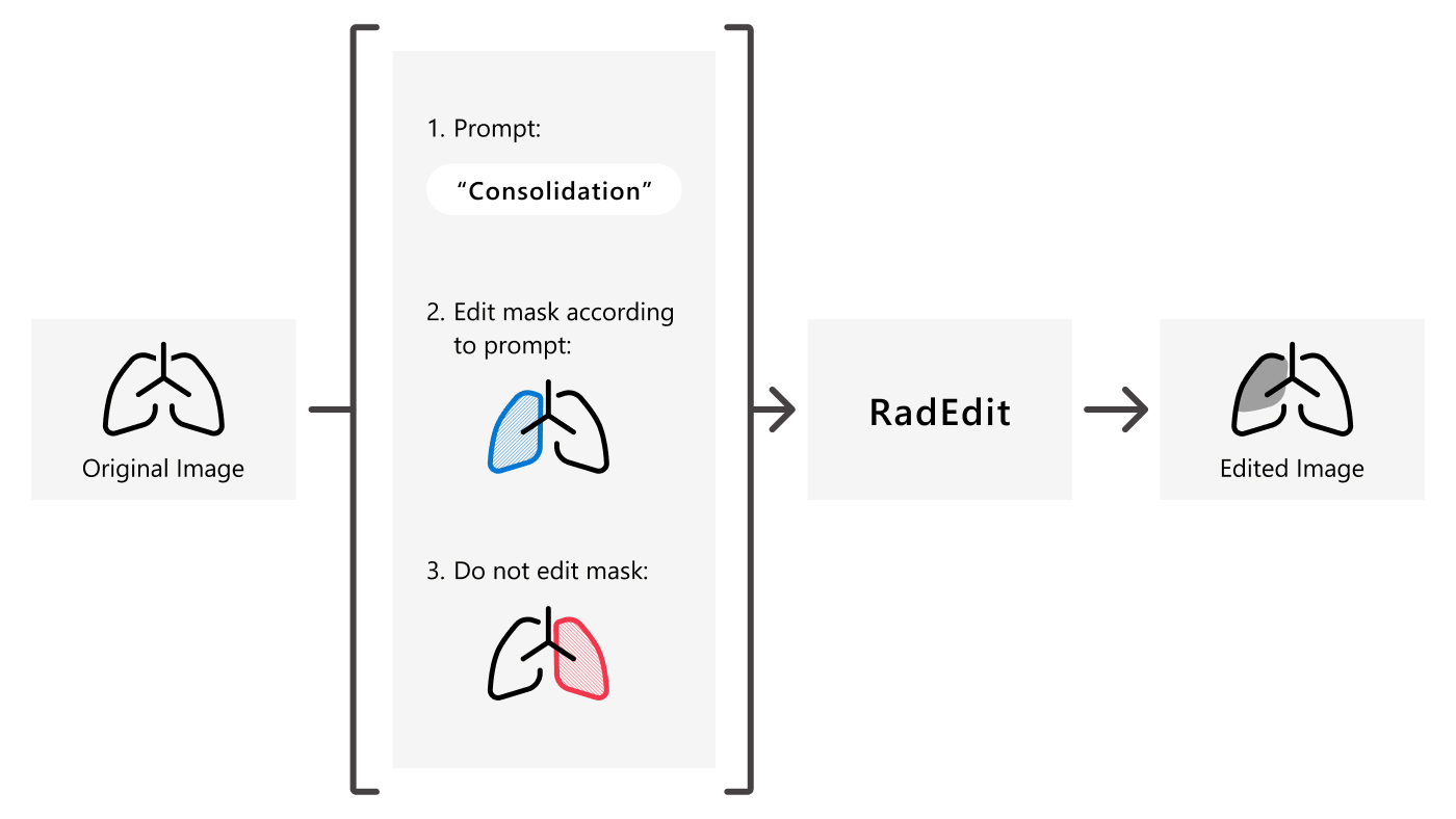  On the left is a simple drawing of the lungs. The drawing shows the borders of the left and right lung as well as the trachea and the left and right main stem bronchi. The text under the drawing reads: Original image. To the right of the drawing are the 3 additional inputs of RadEdit. They are arranged vertically. On top there is an example editing prompt. It reads 