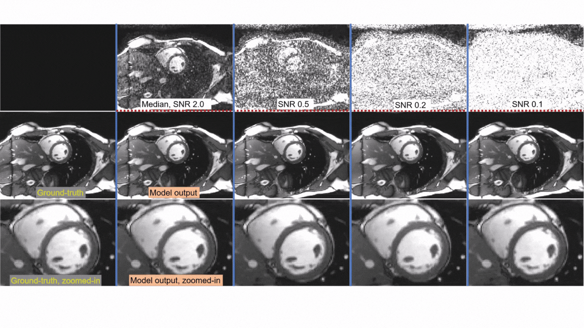 The movies correspond to the example in Figure 1b. The ground-truth clean image is the single one on the left. The first row are the noisy samples. The second row are the SNR images.