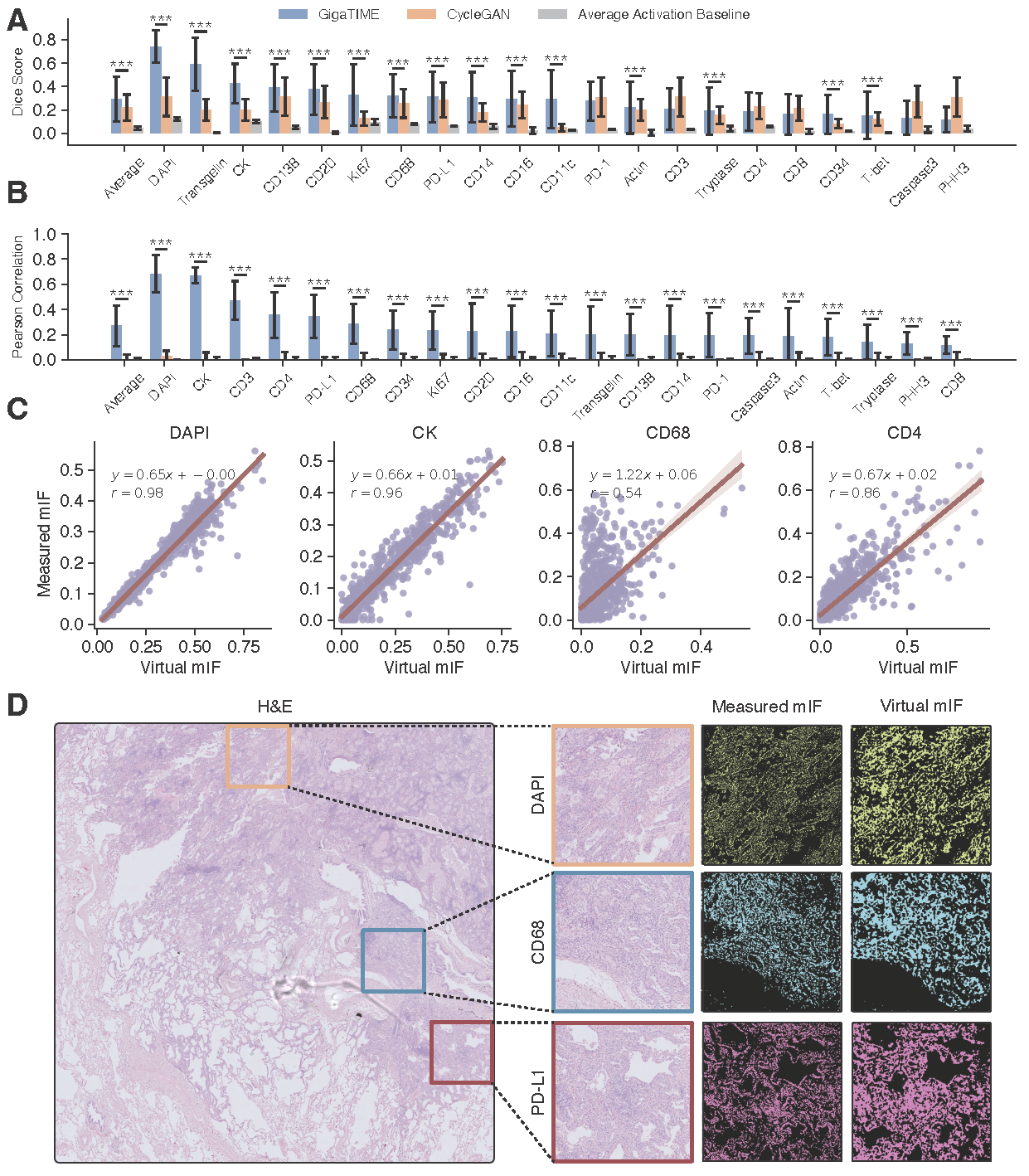 Figure 2. GigaTIME enables translation from hematoxylin and eosin (H&E) to multiplex immunofluorescence (mIF) images. A,B, Bar plot comparing GigaTIME and CycleGAN on the translation performance in terms of Dice score (A) and Pearson correlation (B). C, Scatter plots comparing the activation density of the translated mIF and the ground truth mIF across four channels. D, Qualitative results for a sample H&E whole-slide image from our held-out test set with zoomed-in visualizations of the measured mIF and GigaTIME-translated mIF for DAPI, PD-L1, and CD68 channels.