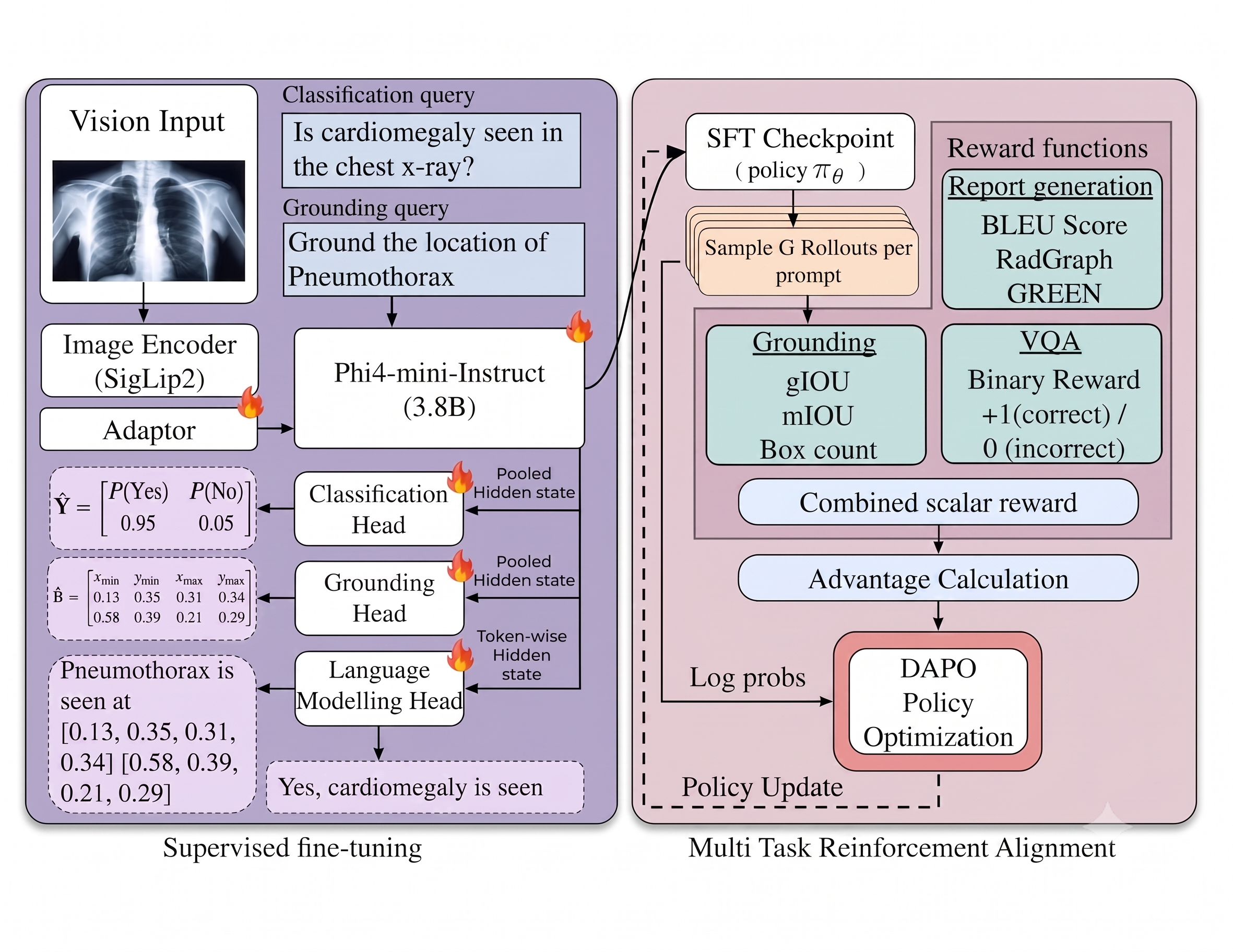 CARE-X architecture with a SigLIP2 vision encoder, Phi-4-mini backbone, classification and grounding auxiliary heads, language modeling, and DAPO alignment for report generation, VQA, and grounding.