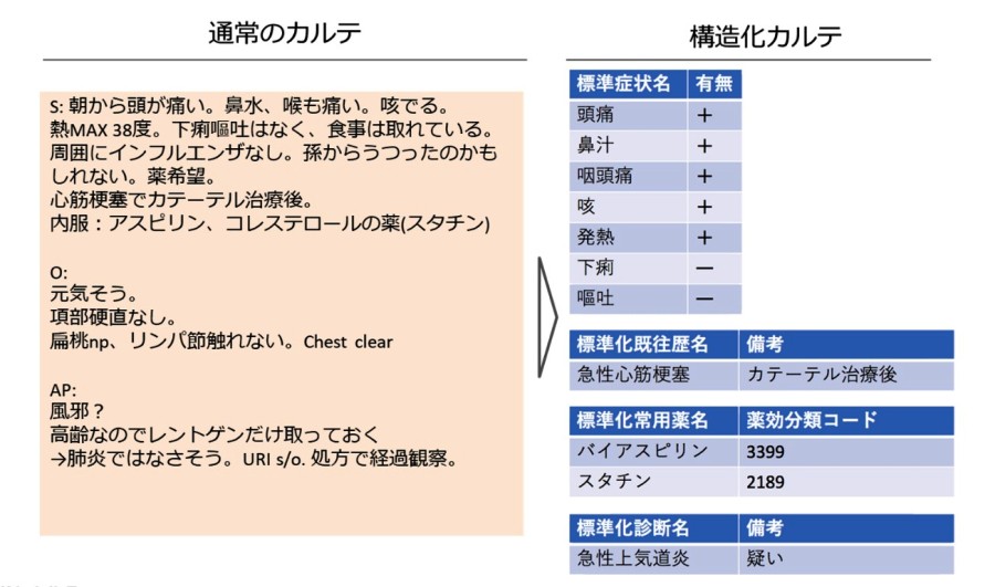 図: 通常のカルテ → 構造化カルテ