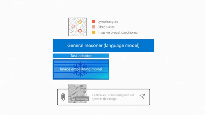 Fig.4 CXRReportGenに悪性細胞の種別の概要を記述させるイメージ 