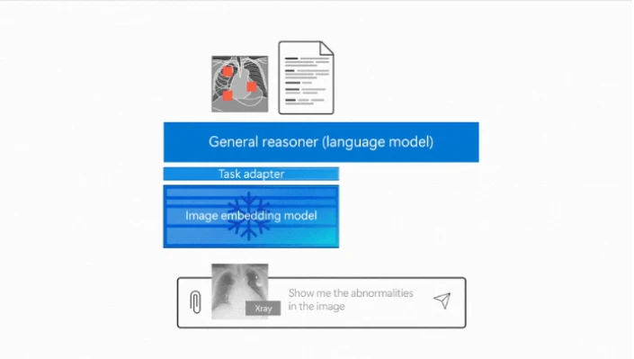 Fig.3 CXRReportGen に異常所見を提示させるイメージ 